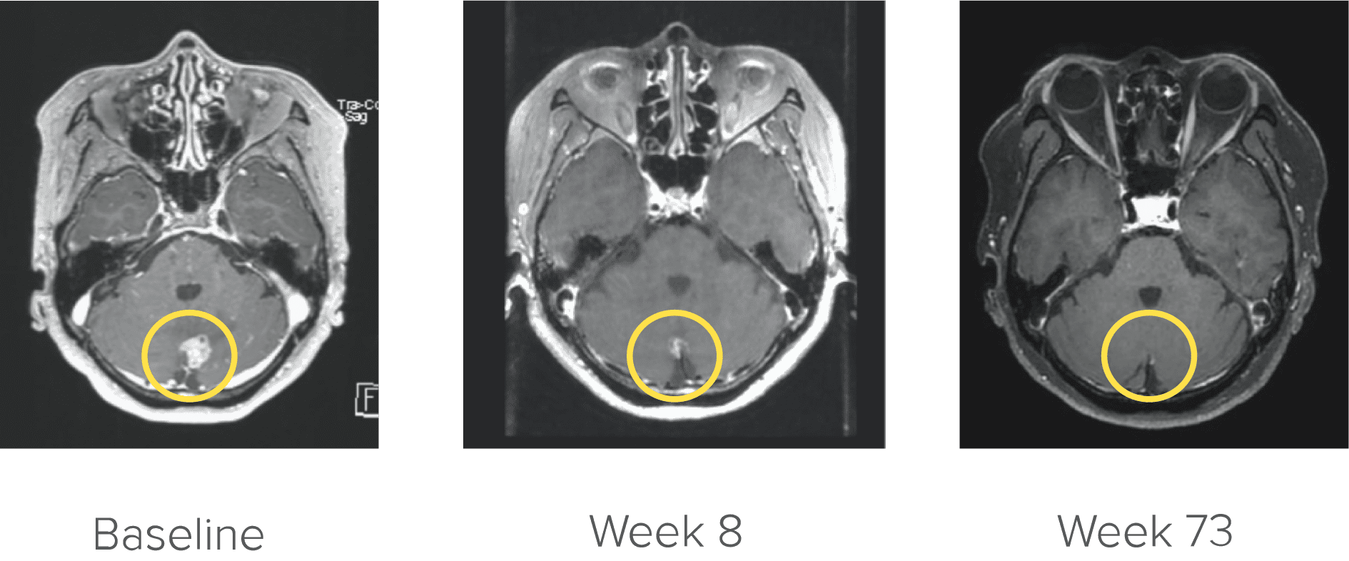 CNS Activity brain chart